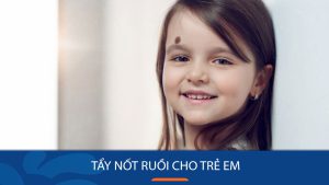 Có nên tẩy nốt ruồi cho trẻ em? Giải đáp thắc mắc của cha mẹ