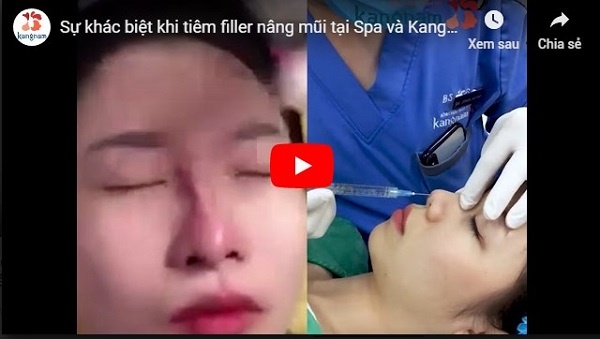 video so sánh