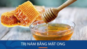 9 Cách trị nám bằng mật ong An toàn – Hiệu quả
