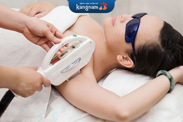 Triệt lông nách vĩnh viễn bằng tia laser