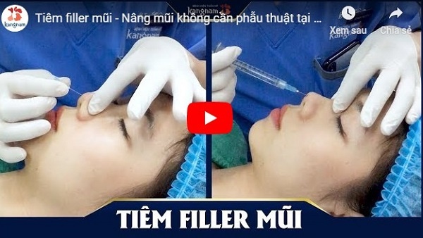 video tiêm filler