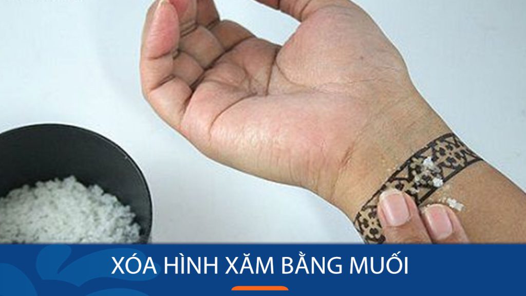 Vì sao xóa hình xăm bằng muối không hề có tác dụng