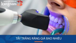 Tẩy trắng răng giá bao nhiêu? Bảng giá tẩy trắng răng tại Kangnam