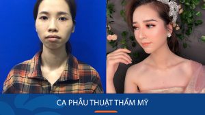 10 Ca phẫu thuật thẩm mỹ gây “chấn động” tại Việt Nam