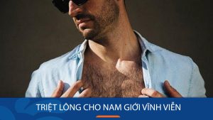 7 Cách Triệt Lông Vĩnh Viễn Cho Nam Giới Hiệu Quả – Nhanh Chóng – An Toàn