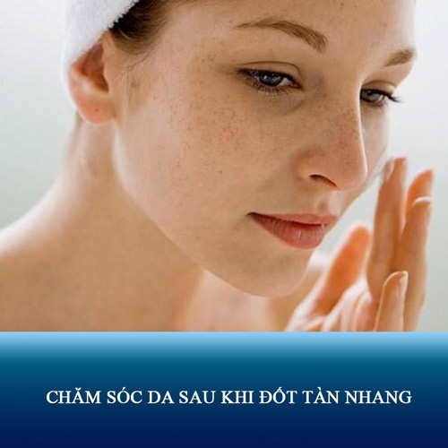 Chăm sóc da sau khi đốt tàn nhang- 5 Tip bắt buộc Phải Nhớ