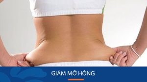 10 Bài tập giảm mỡ hông Nhanh, Xóa tan mỡ eo thần kỳ