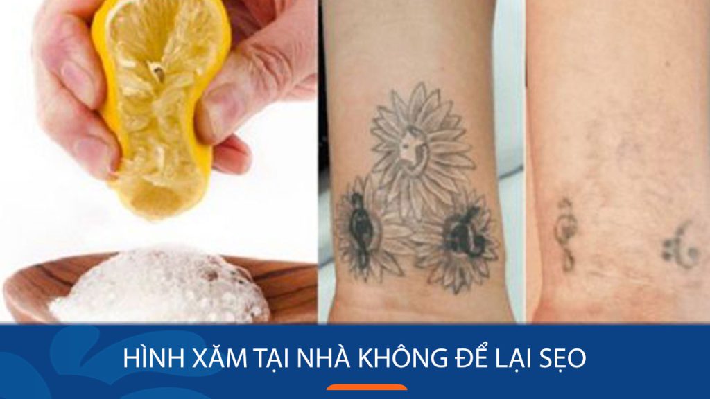 11 cách xóa Hình Xăm tại nhà Không Để Lại Sẹo, NHANH