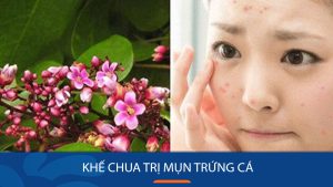 Bí quyết trị mụn trứng cá hiệu quả bằng lá khế chua