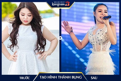 kinh nghiệm tạo hình thành bụng