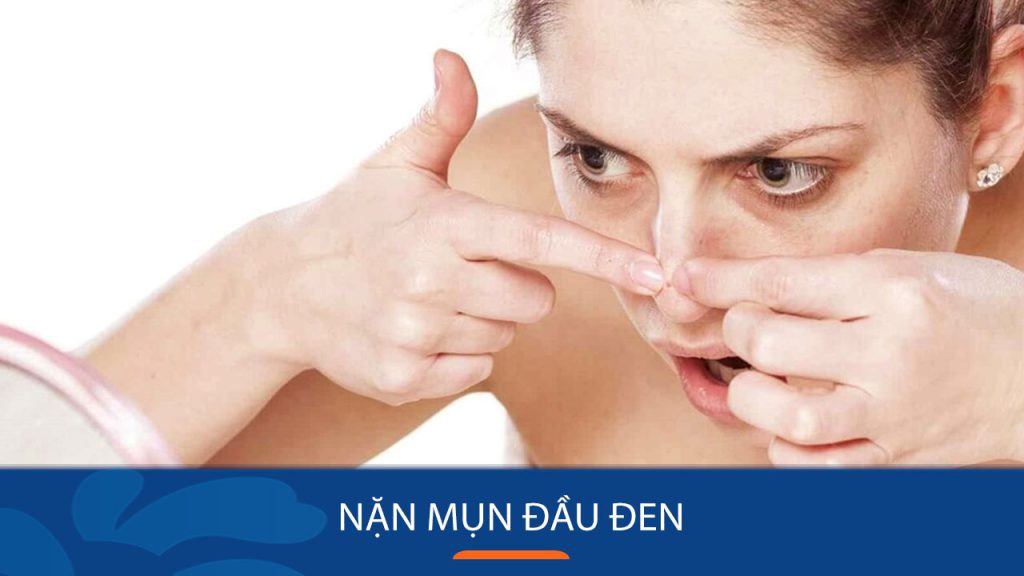 Nặn Mụn Đầu Đen Tại Nhà – Hiệu Quả, An Toàn, Không Sẹo Thâm