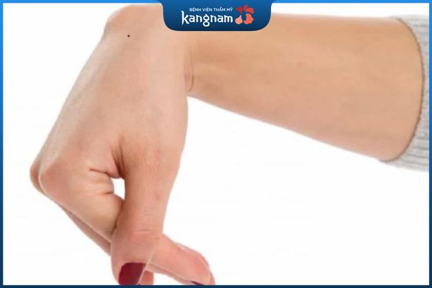Nốt ruồi trên mu cổ tay thường ám chỉ những người có tính kiên định
