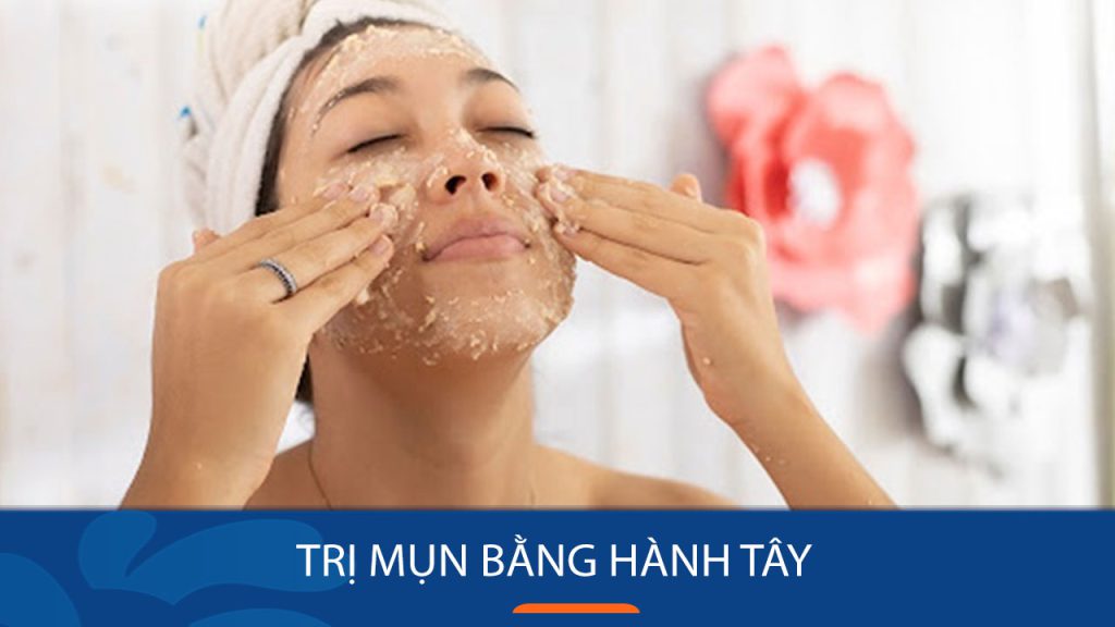 Trị Mụn Hiệu Quả Bất Ngờ Với Hành Tây Chỉ Sau 7 Ngày