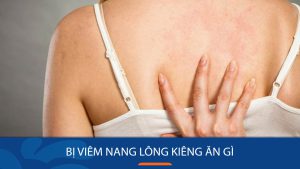 Bí quyết Ăn uống thông minh giúp da nhanh khỏi viêm nang lông