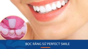 Bọc răng sứ Perfect Smile – Giải pháp phục hình