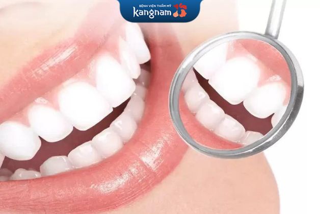 Kangnam ứng dụng công nghệ bọc răng sứ Perfect Smile