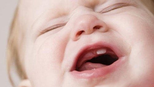 cách chữa vàng răng cho bé