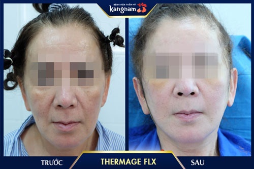 cây massage nâng cơ mặt