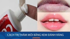 7 Cách trị thâm môi bằng kem đánh răng Nhanh- Hiệu quả