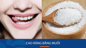 5 Cách lấy cao răng bằng muối tại nhà – Răng trắng sạch