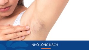 Bí Quyết Nhổ Lông Nách “Nhẹ Nhàng” – Da Mịn Màng, Tự Tin Suốt Ngày Dài