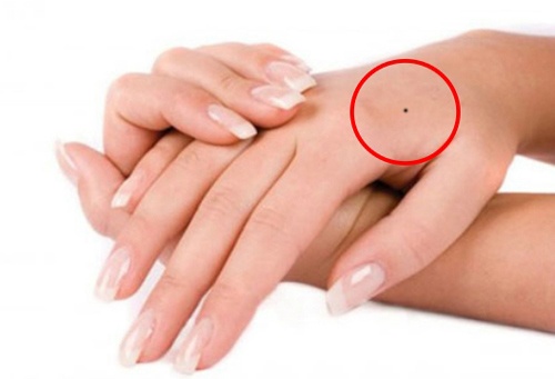 nốt ruồi trên mu bàn tay trái phụ nữ