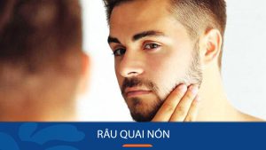 Những Kiểu Râu Quai Nón HOT Nhất Cho Phái Mạnh