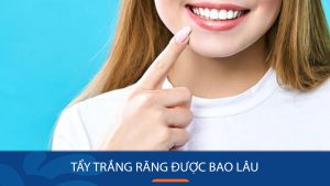 Tẩy trắng răng được bao lâu? Chăm sóc để màu răng bền nhất?