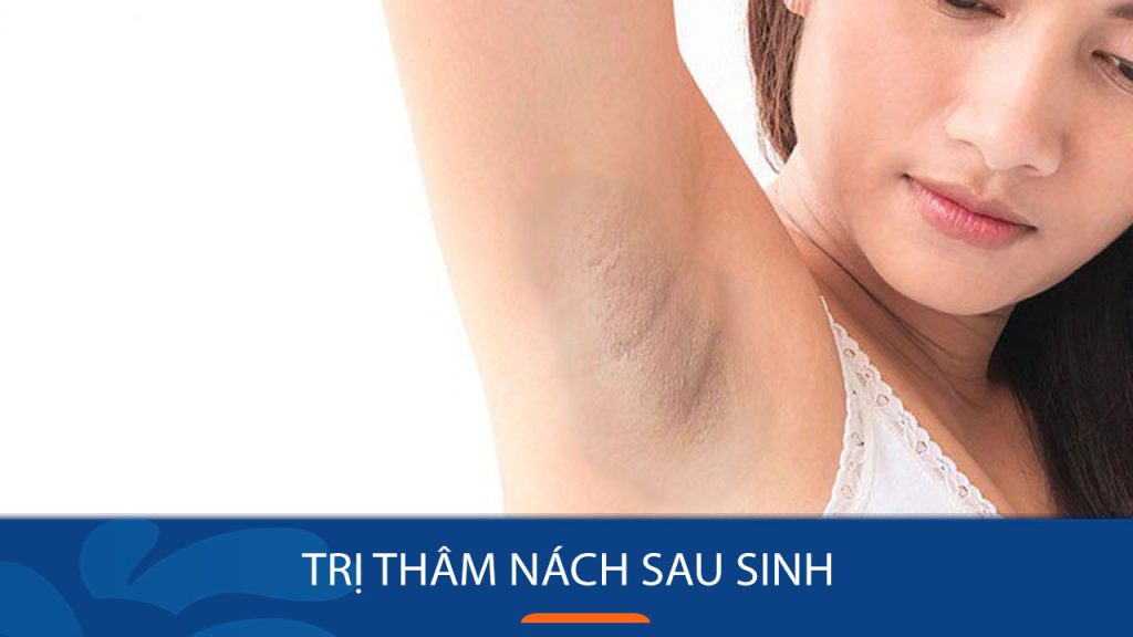 13 Cách trị thâm nách sau sinh – Ngăn mùi, nách trắng mịn
