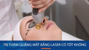 Trị thâm quầng mắt bằng Laser có tốt không?