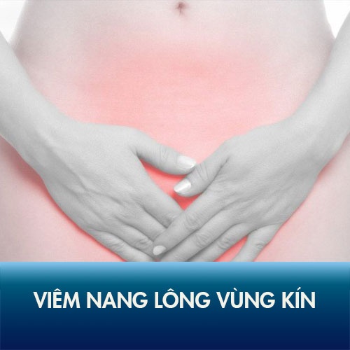 Viêm nang lông vùng kín: Nguyên nhân & cách điều trị hiệu quả nhất