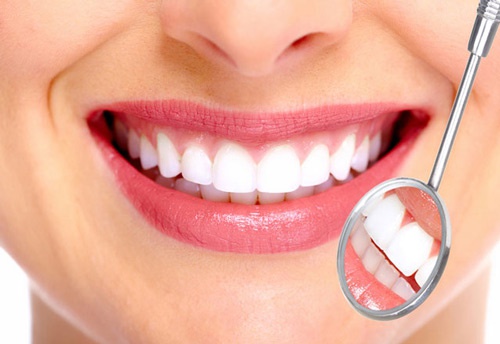 Bọc răng sứ có bền không? Được bao nhiêu năm thì hỏng