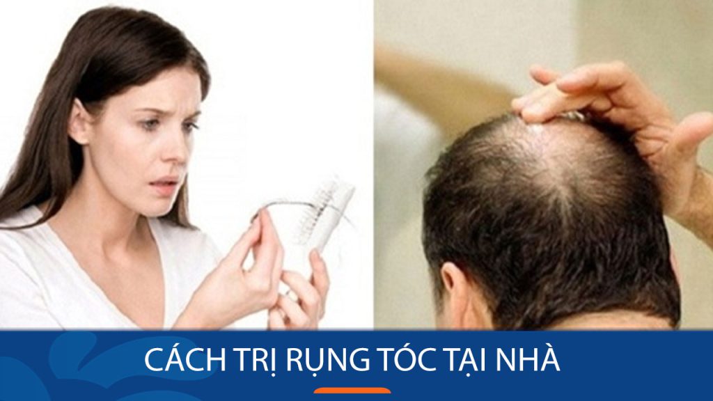 9 cách trị rụng tóc tại nhà Nhanh, Hiệu quả nhất bằng tự nhiên