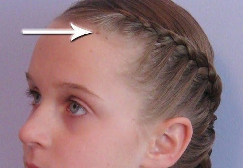 Xem bói nốt ruồi ở tóc mai nói lên điều gì Tốt hay xấu