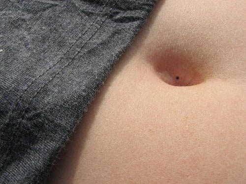nốt ruồi ở bụng phụ nữ