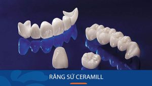 Răng sứ Ceramill là gì? Có mấy loại? Giá bao nhiêu? Có tốt không?