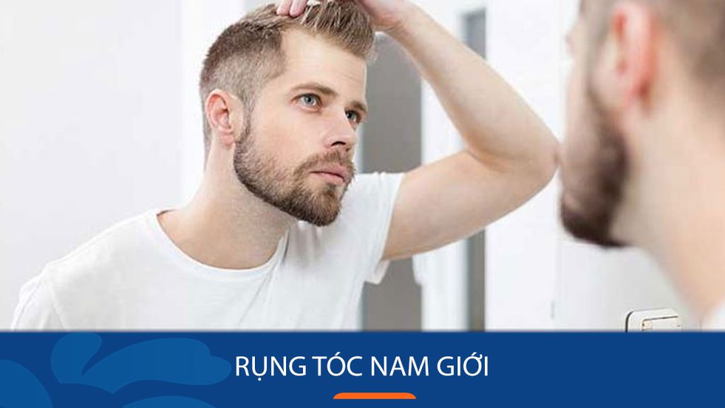 Rụng tóc nam giới: Nguyên nhân và cách điều trị, phòng ngừa
