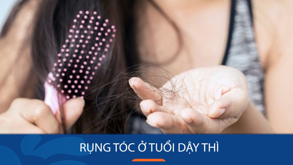 Rụng tóc ở tuổi dậy thì: Nguyên nhân & cách chữa trị dứt điểm