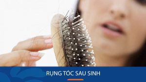 Rụng tóc sau sinh: Nguyên nhân và cách khắc phục triệt để