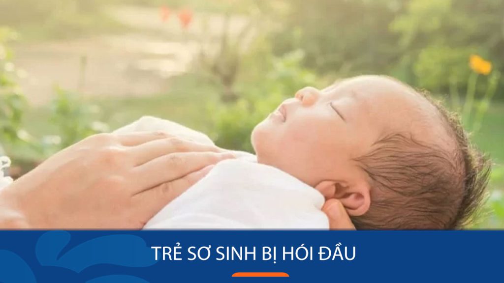 Nguyên nhân trẻ sơ sinh bị hói đầu? 4 Cách phòng tránh