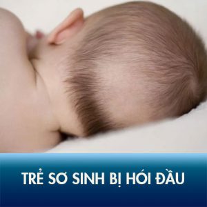 Nguyên nhân trẻ sơ sinh bị hói đầu? 4 Cách phòng tránh