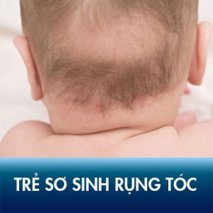 Trẻ sơ sinh bị rụng tóc có nguy hiểm không?