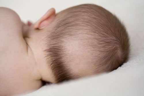 trẻ sơ sinh bị rụng tóc sau gáy