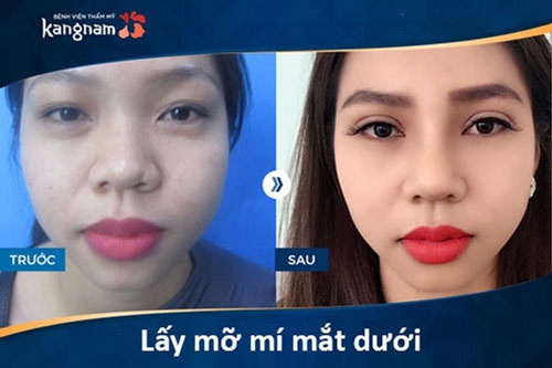 đôi mắt buồn sâu cay