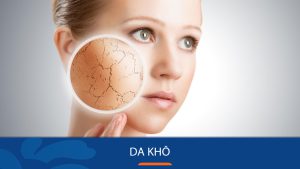 Da khô là gì? 2 Nguyên nhân và 11 bước chăm sóc da mặt khô