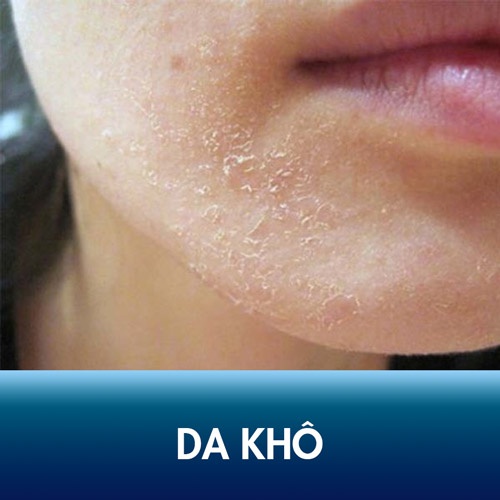  da mặt khô dùng gì 