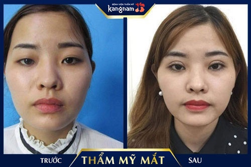 hình ảnh đôi mắt buồn đẹp