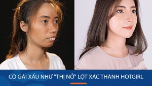 Nguyễn Thị Huê: Cô gái xấu như “Thị Nở” lột xác thành Hotgirl
