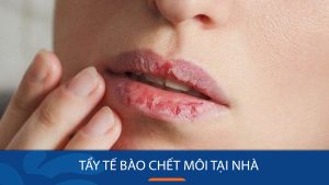 15 Cách tẩy tế bào chết môi tại nhà được hội Beauty blogger