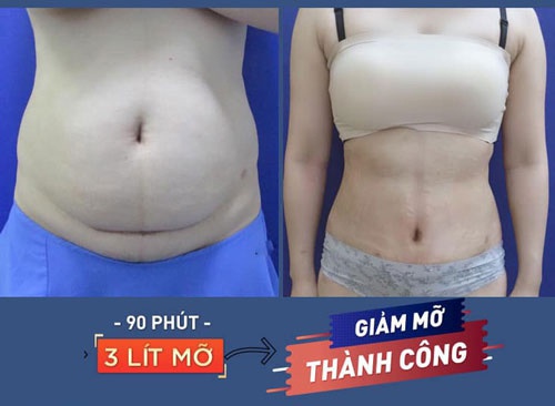 hành tây có giảm cân không 